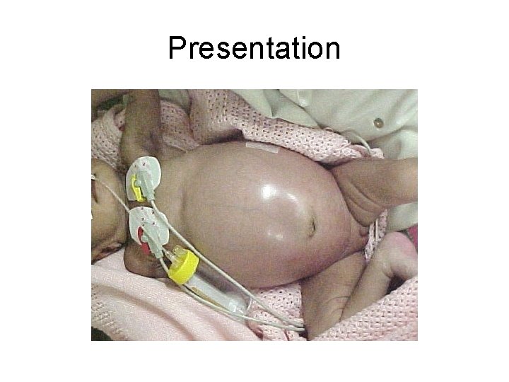 Presentation 