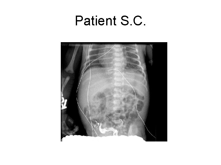 Patient S. C. 