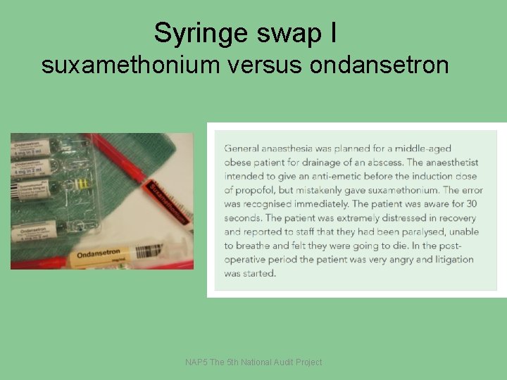 Syringe swap I suxamethonium versus ondansetron NAP 5 The 5 th National Audit Project