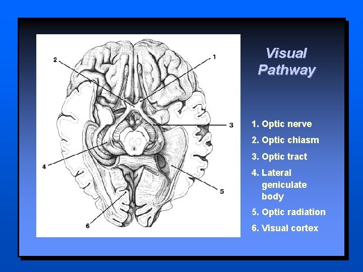 Visual Pathway 1. Optic nerve 2. Optic chiasm 3. Optic tract 4. Lateral geniculate