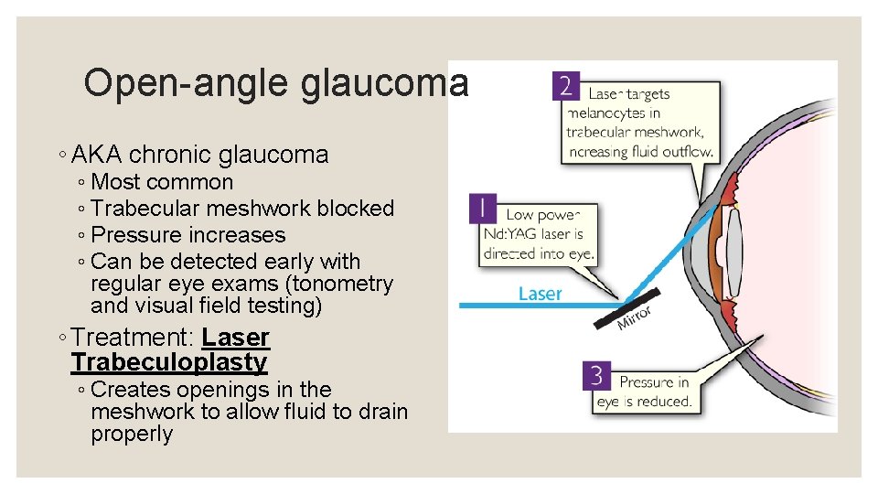 Open-angle glaucoma ◦ AKA chronic glaucoma ◦ Most common ◦ Trabecular meshwork blocked ◦