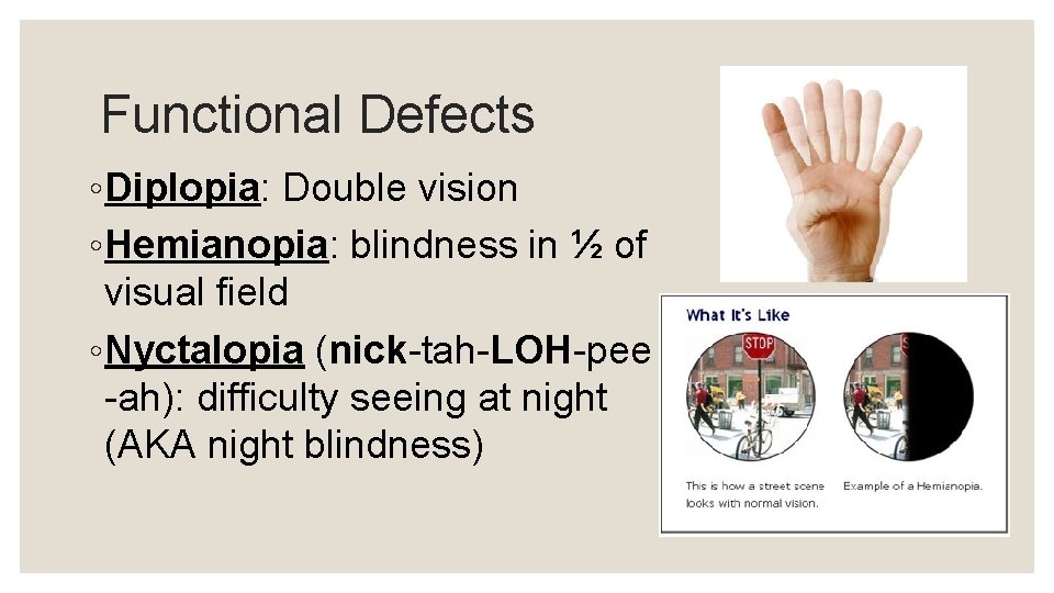 Functional Defects ◦ Diplopia: Double vision ◦ Hemianopia: blindness in ½ of visual field