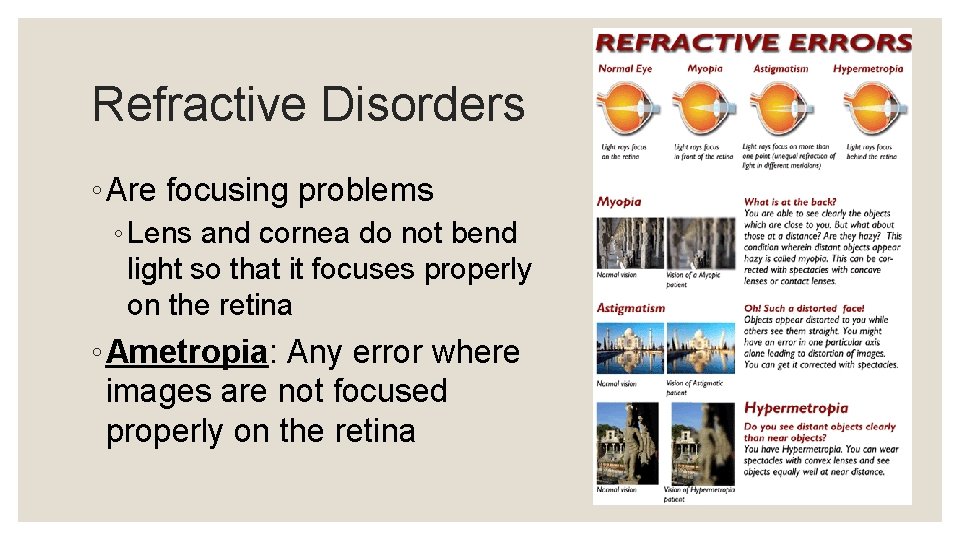 Refractive Disorders ◦ Are focusing problems ◦ Lens and cornea do not bend light