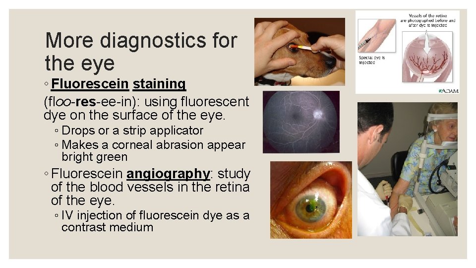 More diagnostics for the eye ◦ Fluorescein staining (floo-res-ee-in): using fluorescent dye on the