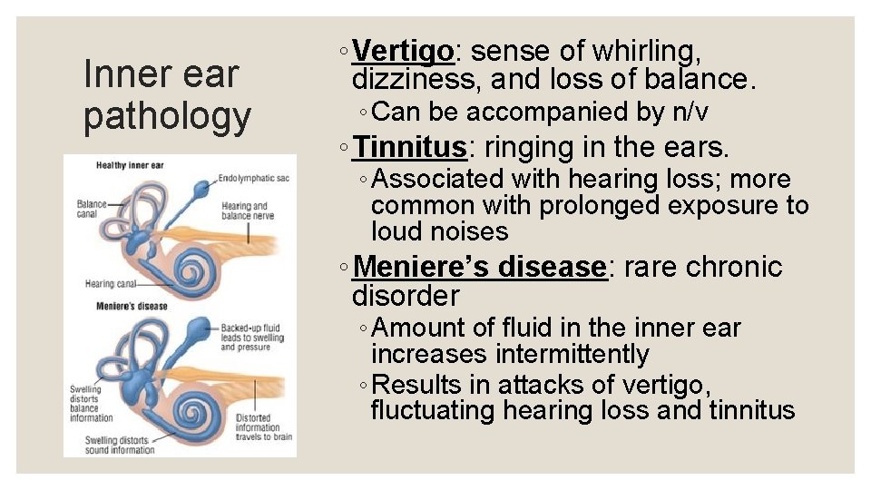 Inner ear pathology ◦ Vertigo: sense of whirling, dizziness, and loss of balance. ◦