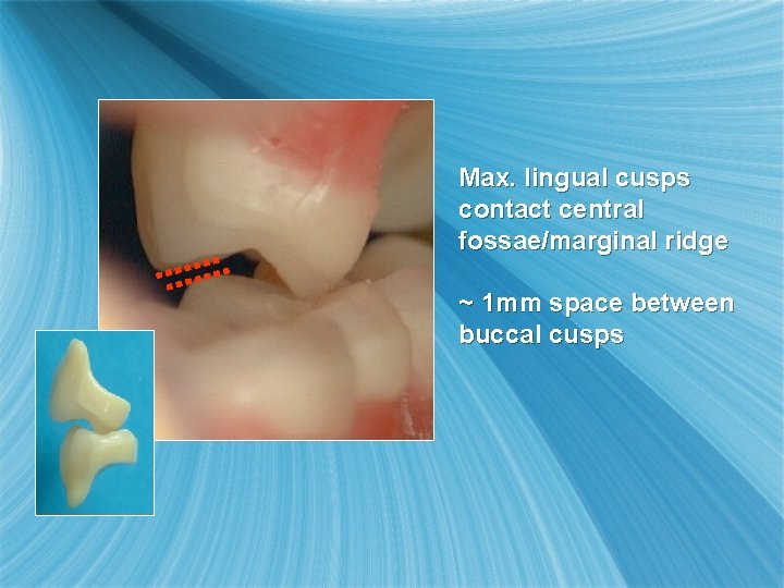 Max. lingual cusps contact central fossae/marginal ridge ~ 1 mm space between buccal cusps