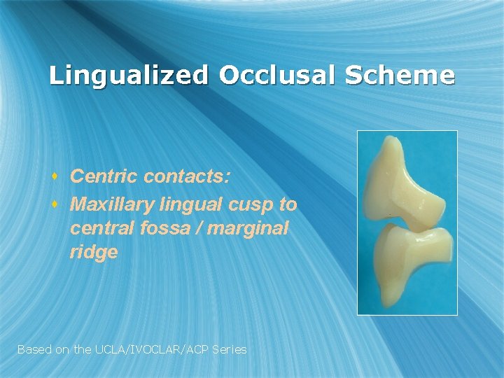 Lingualized Occlusal Scheme s Centric contacts: s Maxillary lingual cusp to central fossa /