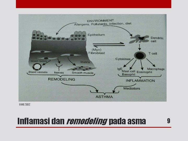 GINA 2002 Inflamasi dan remodeling pada asma 9 