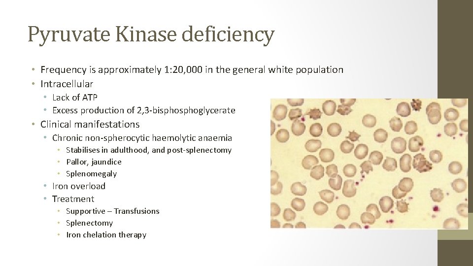 Pyruvate Kinase deficiency • Frequency is approximately 1: 20, 000 in the general white