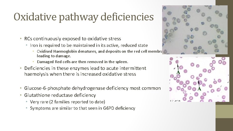 Oxidative pathway deficiencies • RCs continuously exposed to oxidative stress • Iron is required