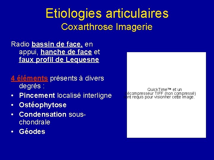 Etiologies articulaires Coxarthrose Imagerie Radio bassin de face, en appui, hanche de face et