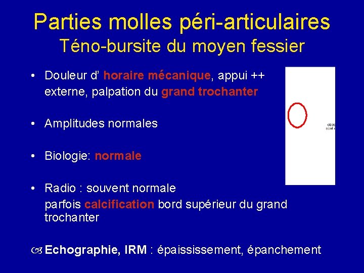 Parties molles péri-articulaires Téno-bursite du moyen fessier • Douleur d’ horaire mécanique, appui ++