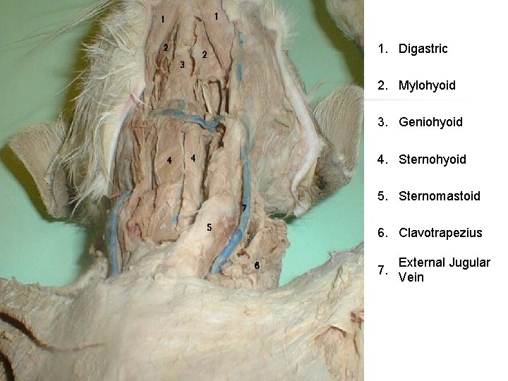 1. Digastric 2. Mylohyoid 3. Geniohyoid 4. Sternohyoid 5. Sternomastoid 6. Clavotrapezius 7. External 1. Digastric 2. Mylohyoid 3. Geniohyoid 4. Sternohyoid 5. Sternomastoid 6. Clavotrapezius 7. External