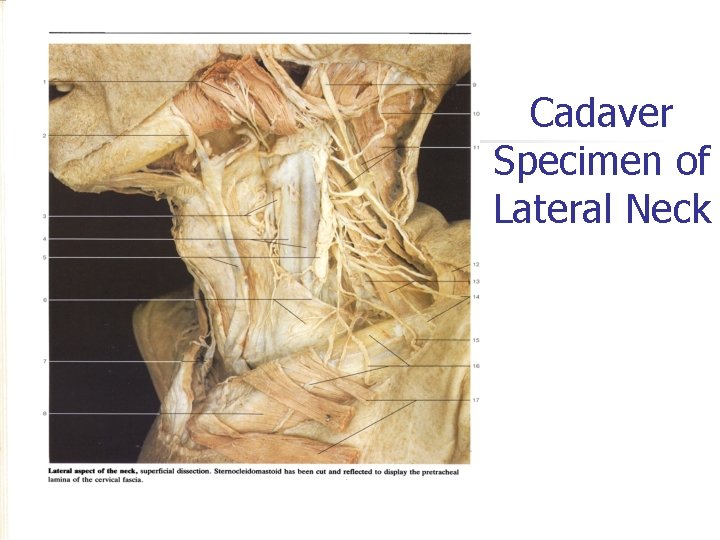 Cadaver Specimen of Lateral Neck Cadaver Specimen of Lateral Neck