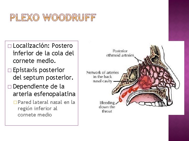 � Localización: Postero inferior de la cola del cornete medio. � Epistaxis posterior del