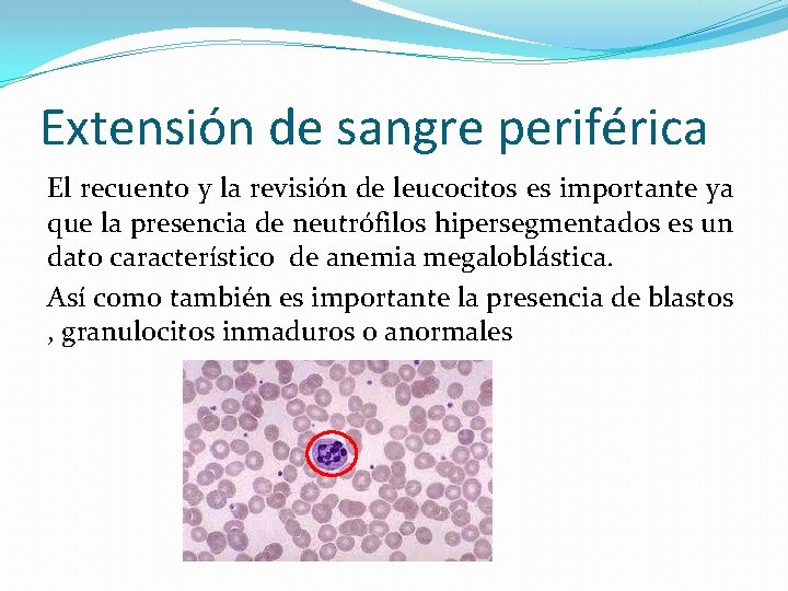 Extensión de sangre periférica El recuento y la revisión de leucocitos es importante ya Extensión de sangre periférica El recuento y la revisión de leucocitos es importante ya