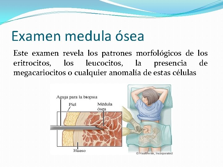 Examen medula ósea Este examen revela los patrones morfológicos de los eritrocitos, los leucocitos, Examen medula ósea Este examen revela los patrones morfológicos de los eritrocitos, los leucocitos,