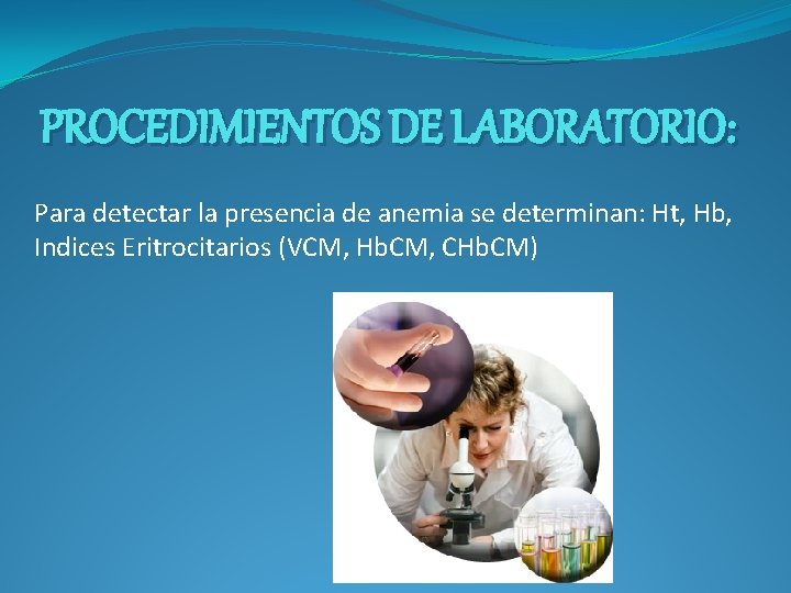 PROCEDIMIENTOS DE LABORATORIO: Para detectar la presencia de anemia se determinan: Ht, Hb, Indices PROCEDIMIENTOS DE LABORATORIO: Para detectar la presencia de anemia se determinan: Ht, Hb, Indices