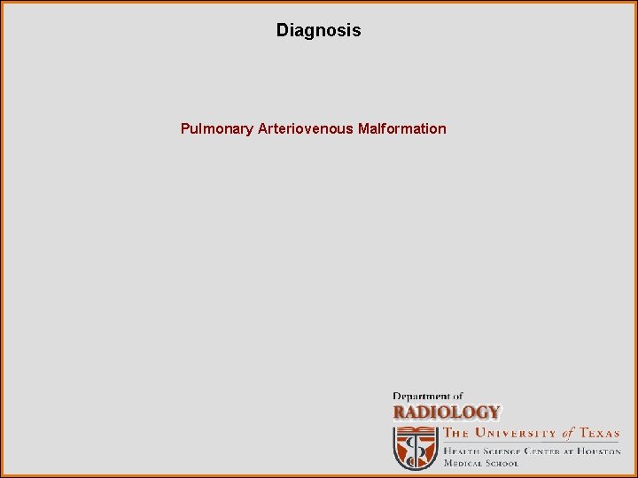 Diagnosis Pulmonary Arteriovenous Malformation 