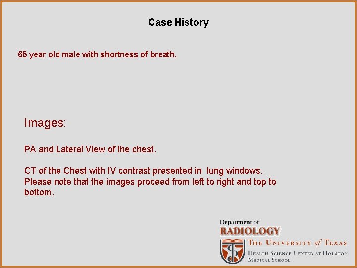 Case History 65 year old male with shortness of breath. Images: PA and Lateral