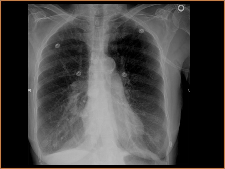 Radiological Presentations 104487887 