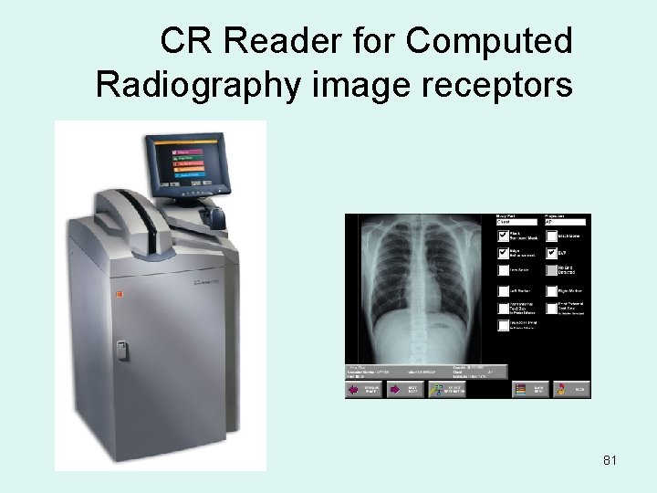 CR Reader for Computed Radiography image receptors 81 