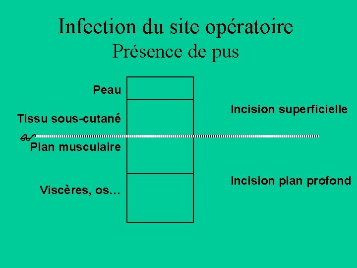 Infection du site opératoire Présence de pus Peau Tissu sous-cutané $ Plan musculaire Viscères,