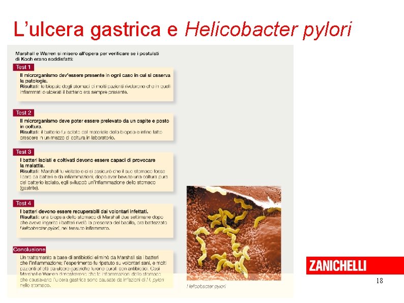 L’ulcera gastrica e Helicobacter pylori 18 Sadava et al. Biologia. blu © Zanichelli editore, L’ulcera gastrica e Helicobacter pylori 18 Sadava et al. Biologia. blu © Zanichelli editore,
