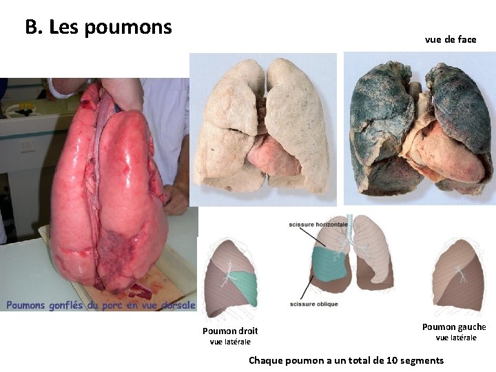 B. Les poumons vue de face Poumon droit vue latérale Poumon gauche vue latérale