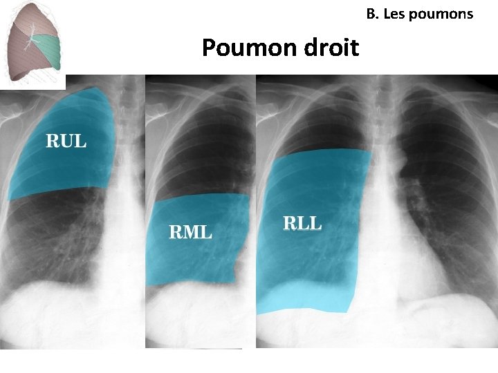 B. Les poumons Poumon droit 