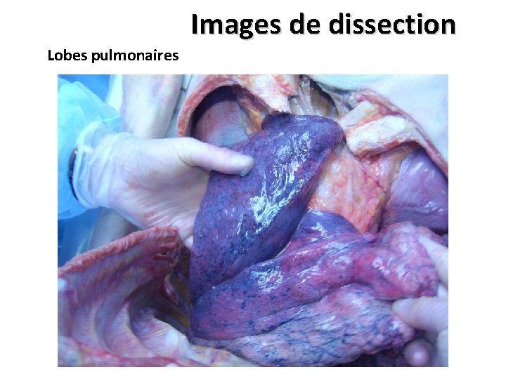 Images de dissection Lobes pulmonaires 