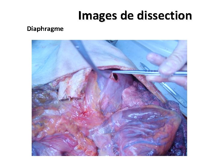 Images de dissection Diaphragme 