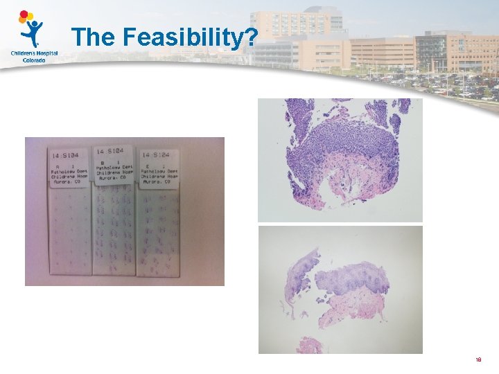 The Feasibility? 18 