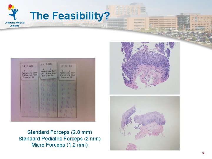 The Feasibility? Standard Forceps (2. 8 mm) Standard Pediatric Forceps (2 mm) Micro Forceps