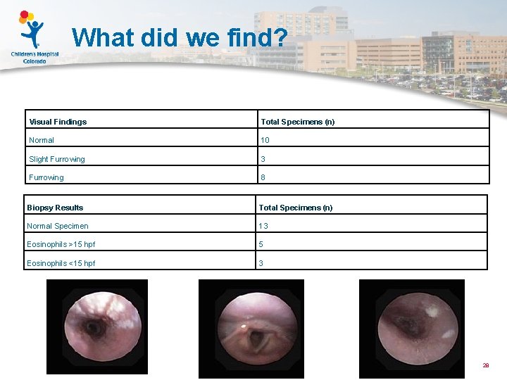 What did we find? Visual Findings Total Specimens (n) Normal 10 Slight Furrowing 3