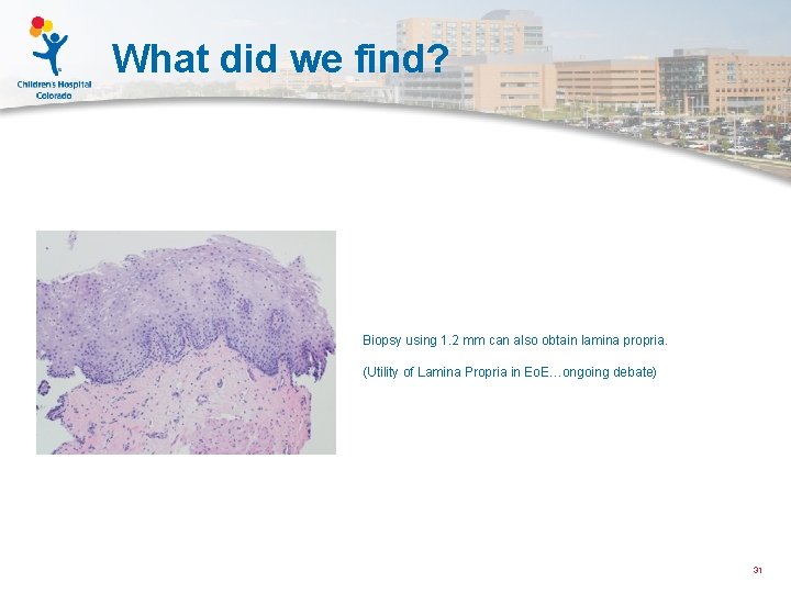 What did we find? Biopsy using 1. 2 mm can also obtain lamina propria.