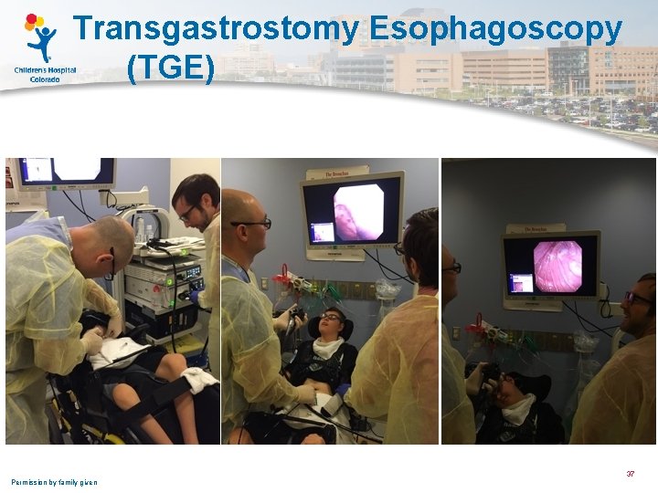 Transgastrostomy Esophagoscopy (TGE) Permission by family given 37 
