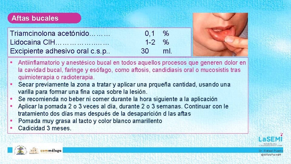 Aftas bucales Triamcinolona acetónido……… Lidocaina Cl. H……………. . …… Excipiente adhesivo oral c. s.