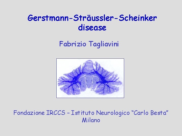 Gerstmann-Sträussler-Scheinker disease Fabrizio Tagliavini Fondazione IRCCS – Istituto Neurologico “Carlo Besta” Milano 