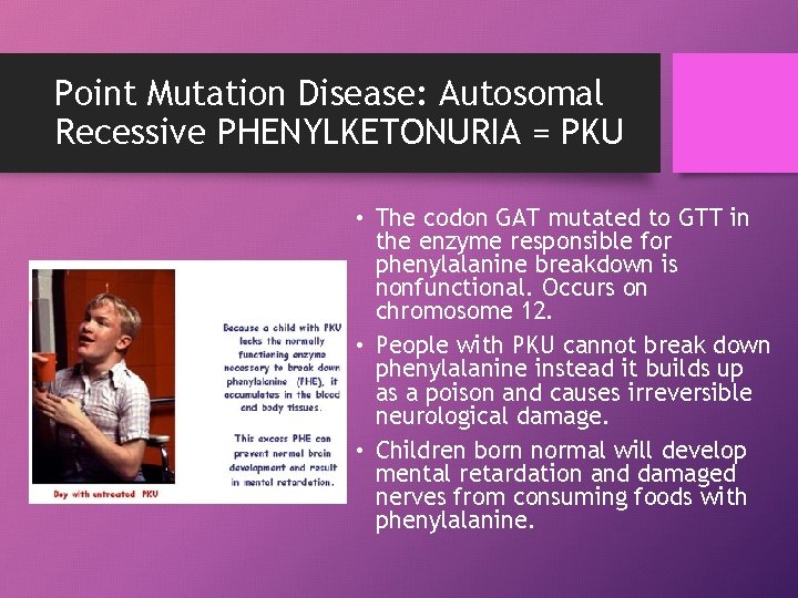 Point Mutation Disease: Autosomal Recessive PHENYLKETONURIA = PKU • The codon GAT mutated to