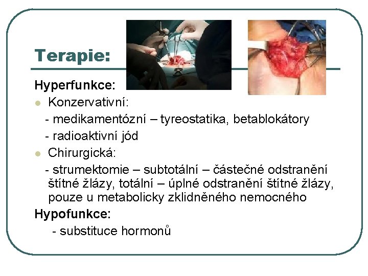 Terapie: Hyperfunkce: l Konzervativní: - medikamentózní – tyreostatika, betablokátory - radioaktivní jód l Chirurgická: