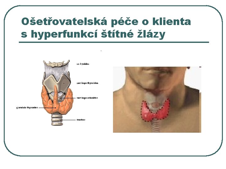 Ošetřovatelská péče o klienta s hyperfunkcí štítné žlázy 