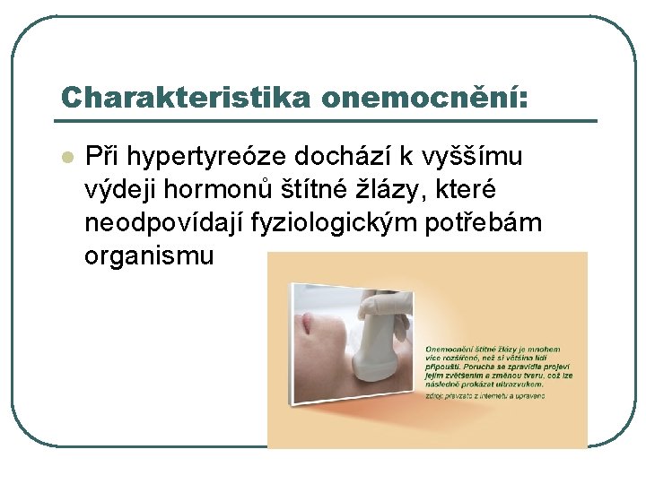 Charakteristika onemocnění: l Při hypertyreóze dochází k vyššímu výdeji hormonů štítné žlázy, které neodpovídají