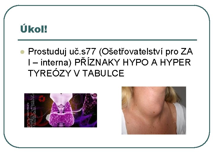 Úkol! l Prostuduj uč. s 77 (Ošetřovatelství pro ZA I – interna) PŘÍZNAKY HYPO