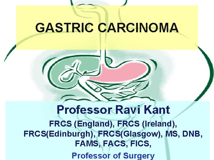 GASTRIC CARCINOMA Professor Ravi Kant FRCS (England), FRCS (Ireland), FRCS(Edinburgh), FRCS(Glasgow), MS, DNB, FAMS,