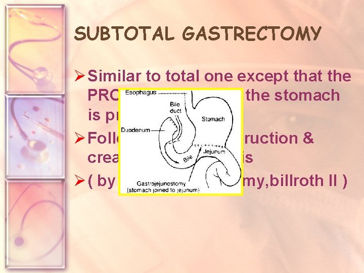 SUBTOTAL GASTRECTOMY Ø Similar to total one except that the PROXIMAL PART of the