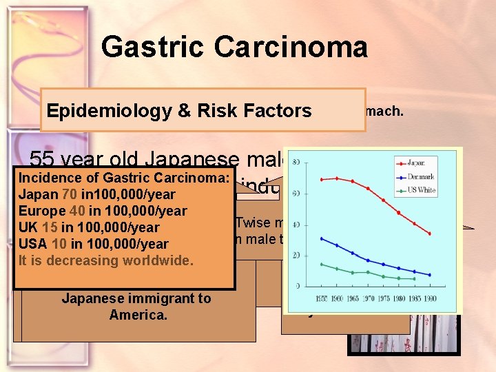 Gastric Carcinoma lesion of the stomach. Epidemiology Risk Factors DEFINITION &Malignant 55 year old