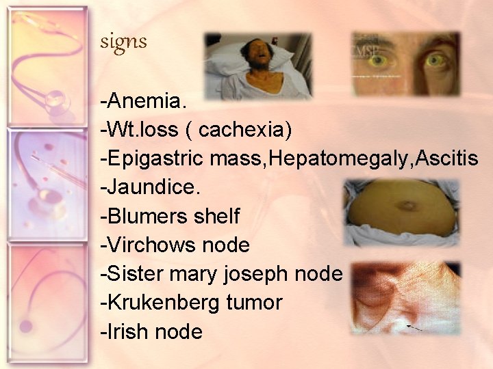 signs -Anemia. -Wt. loss ( cachexia) -Epigastric mass, Hepatomegaly, Ascitis -Jaundice. -Blumers shelf -Virchows