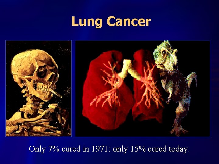 Lung Cancer Only 7% cured in 1971: only 15% cured today. 