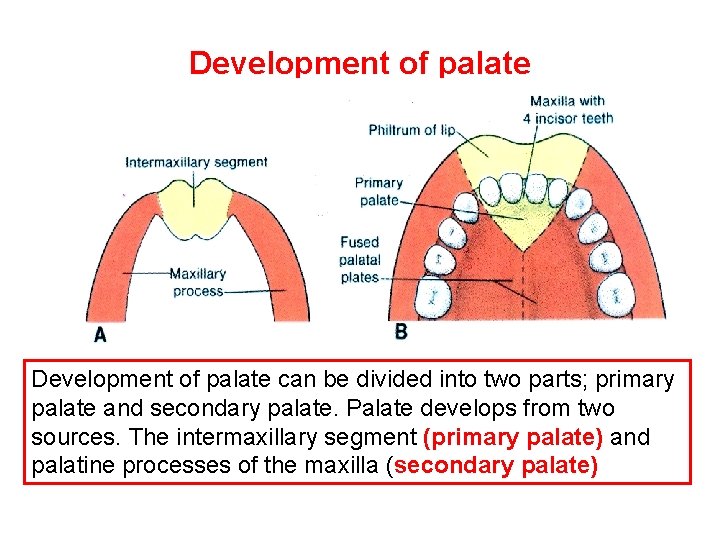 Development of palate can be divided into two parts; primary palate and secondary palate.